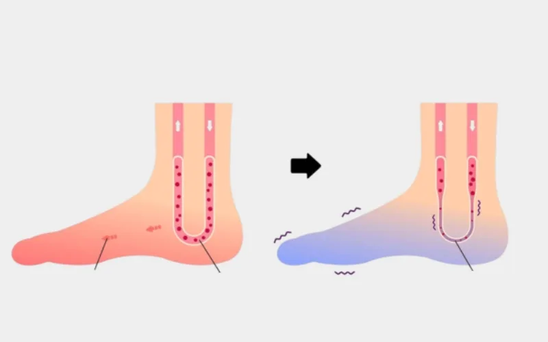 발 마사지 방법