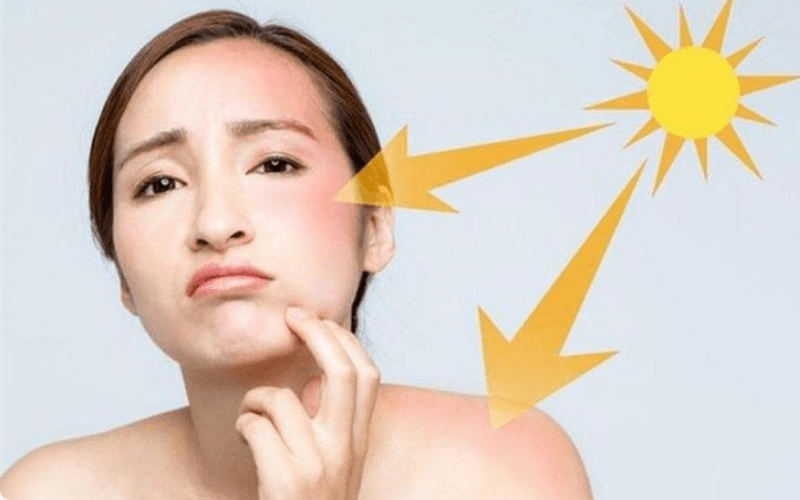 Cách Chọn Kem Chống Nắng Phù Hợp