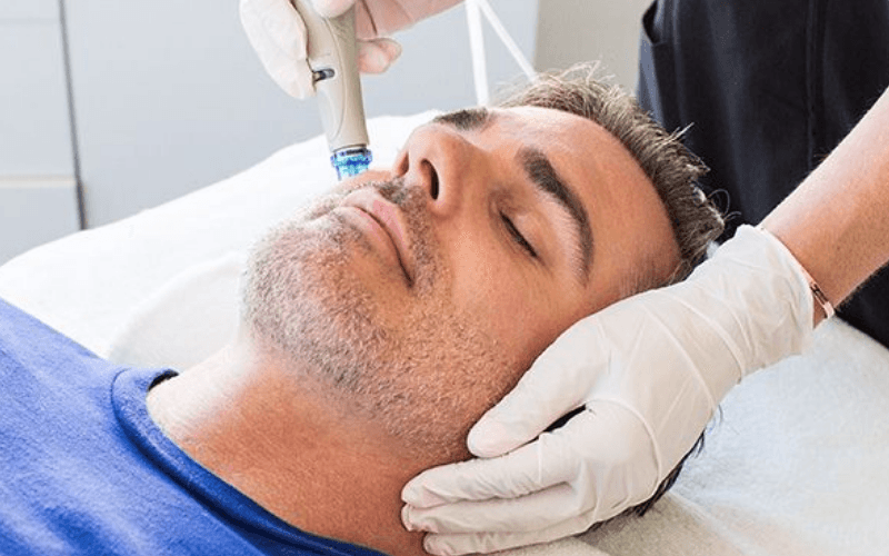 Dưỡng ẩm – khóa ẩm bằng máy điện di lạnh