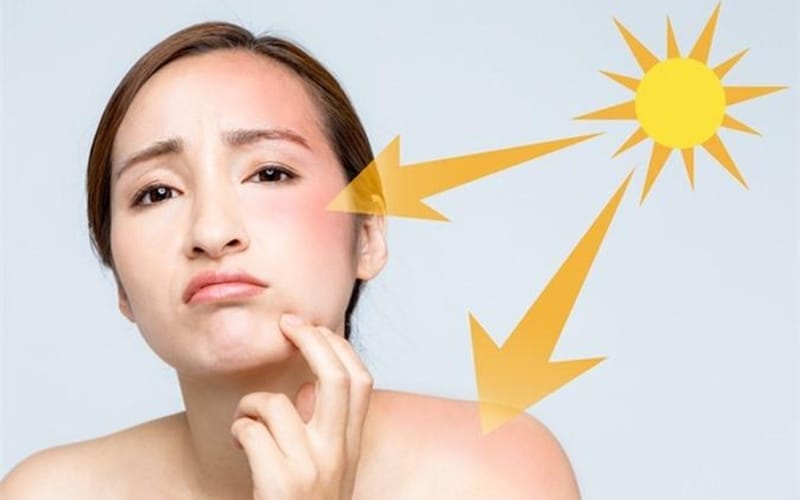 Mistakes in Moisturizing & Sun Protection