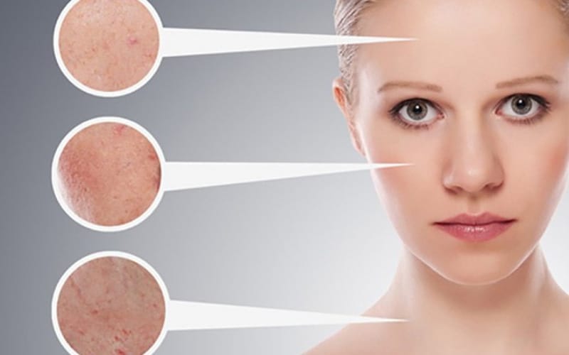 Identifying Your Skin Type: Why It Matters