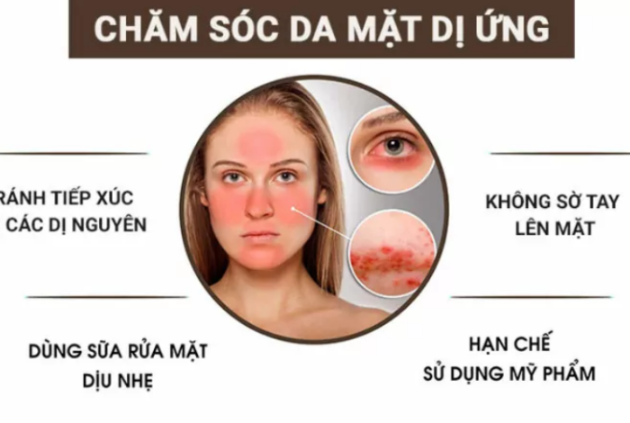Chăm sóc da mặt dị ứng – Hướng dẫn toàn diện