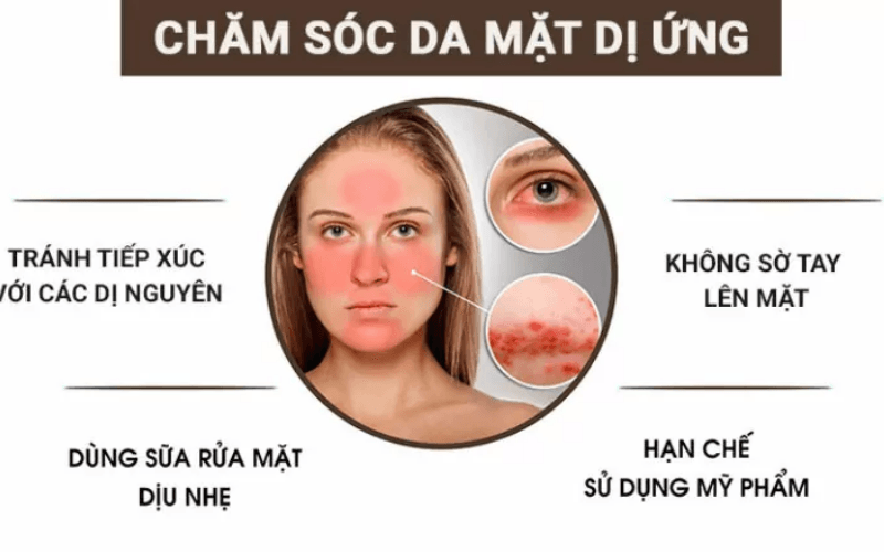 chăm sóc da mặt dị ứng