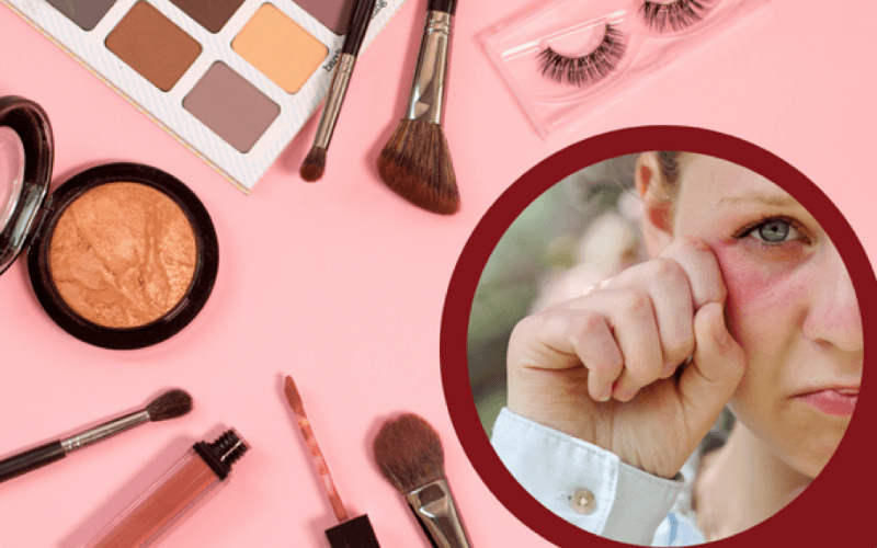 chăm sóc da mặt dị ứng