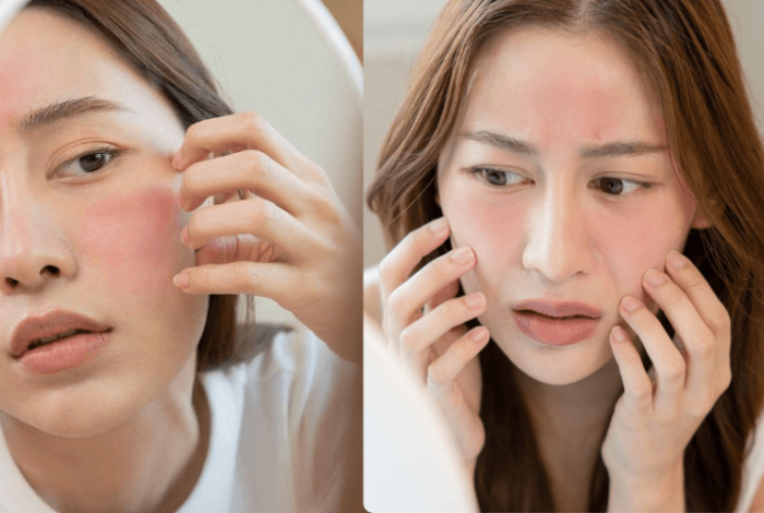 Chăm Sóc Da Mặt Mùa Lạnh: Bí Quyết Giữ Da Ẩm Mịn