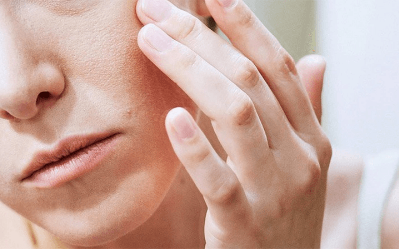 Chăm Sóc Da Sau Lột Da Mặt