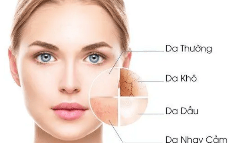trị mụn đầu đen