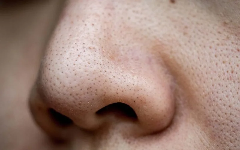 심층 얼굴 클렌징