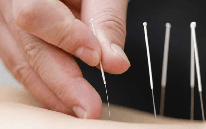 các loại huyệt đạo quan trọng