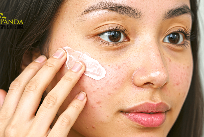 痤疮治疗洁面乳帮助清洁和恢复皮肤