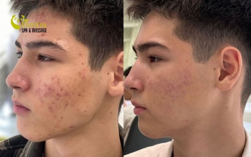 steps for facial skin care