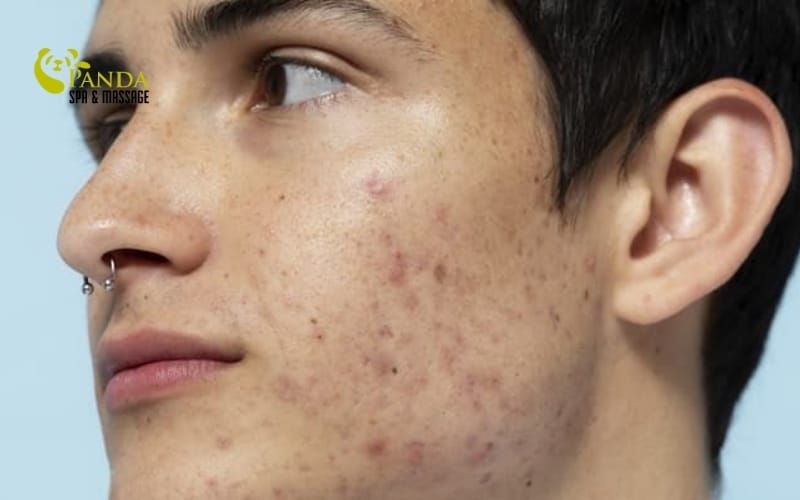 steps for facial skin care