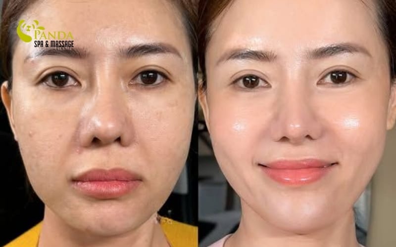 How to take care of skin at home