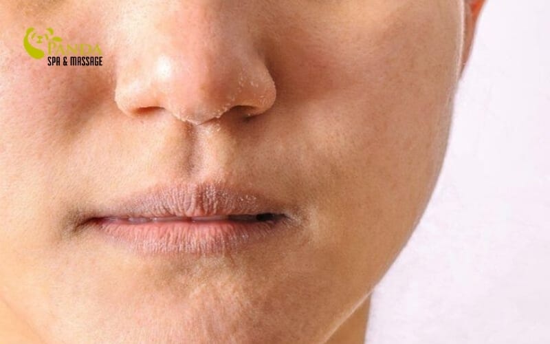  chăm sóc da mặt mùa đông