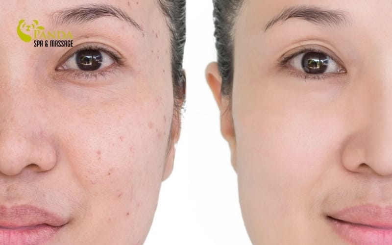 summer facial skin care