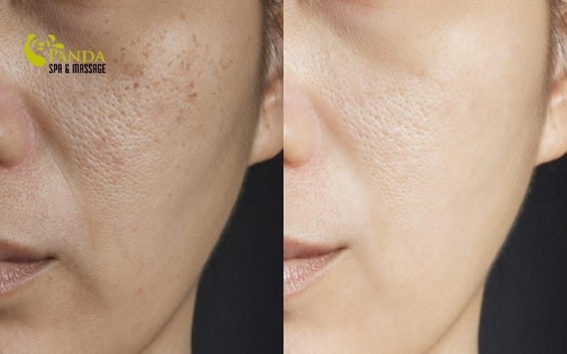 postpartum skin care