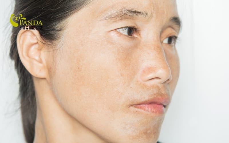 postpartum skin care