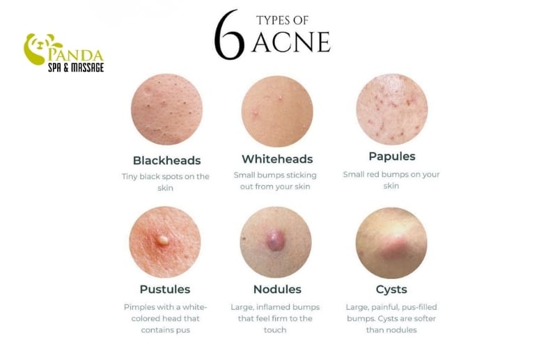 スキンケア化粧品