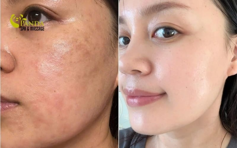 washing face correctly