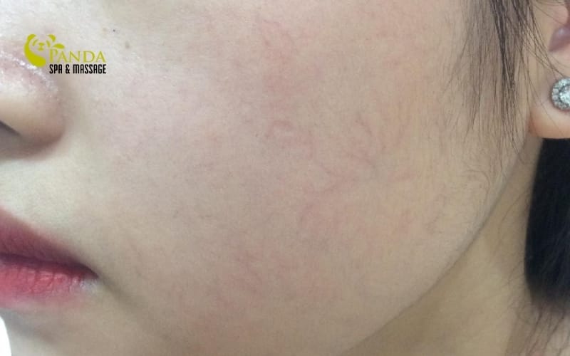  sữa rửa mặt cho trẻ em