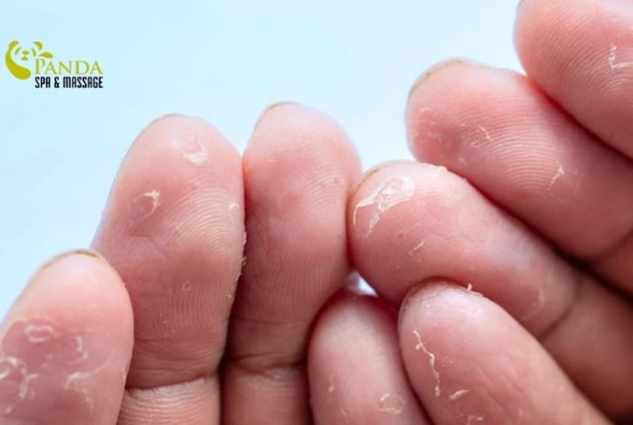 (English) Peeling Hand Skin: Causes and Quick Recovery Methods