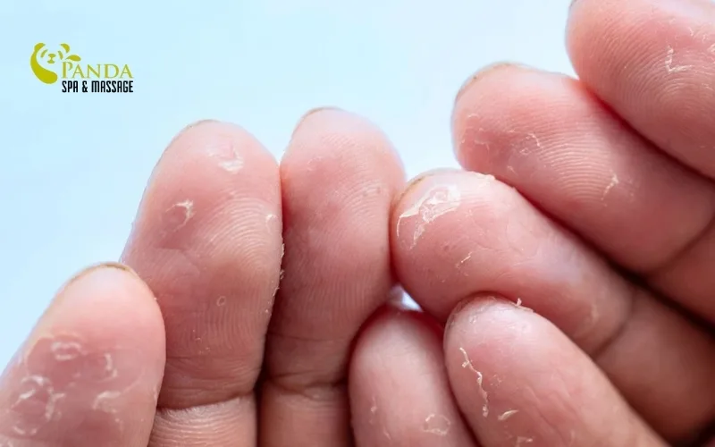 Peeling Hand Skin: Causes and Quick Recovery Methods
