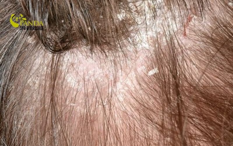 cách làm sạch gàu