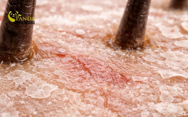 cách làm sạch gàu