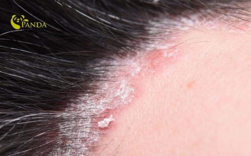 cách làm sạch gàu