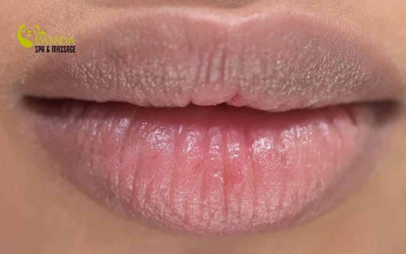 cách trị thâm môi