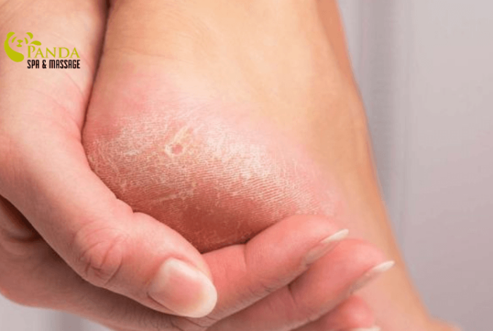 (English) Foot Skin Care: Effective Ways for Soft, Smooth, Crack-Free Feet