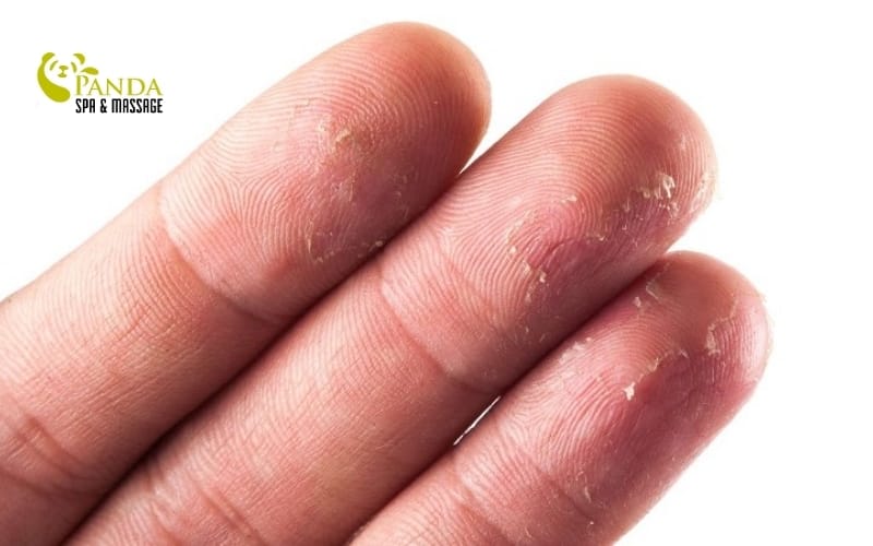 dry hand skin