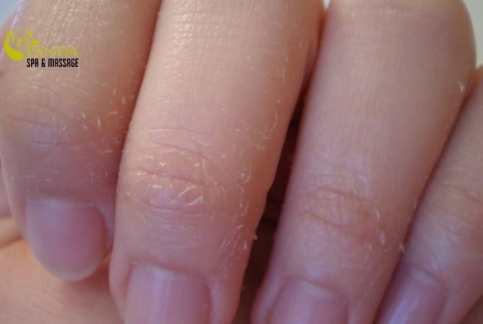 (English) Dry Hand Skin: Causes and Effective Recovery Methods